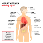 Coronary heart disease