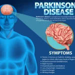 parkinsons-disease